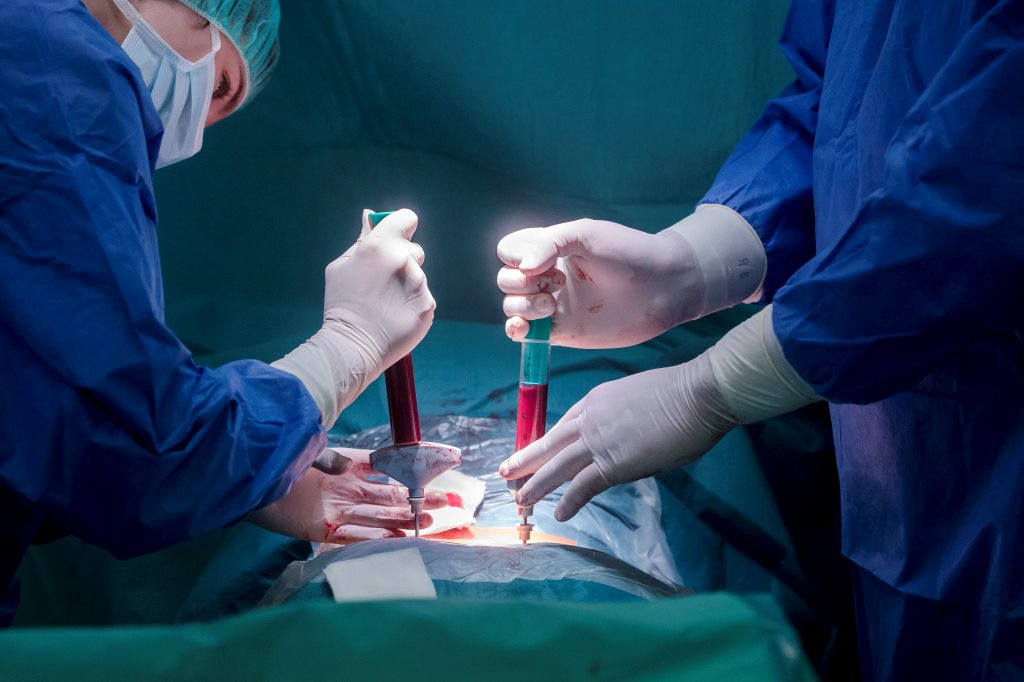 Terobosan Terbaru Teknologi Stem Cell: Harapan Baru Dunia Medis