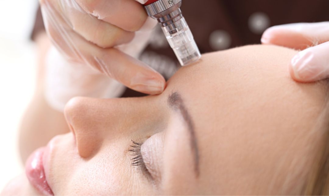 Terapi Stem Cell: Menyelamatkan Lansia dari Berbagai Penyakit di Tahun 2025