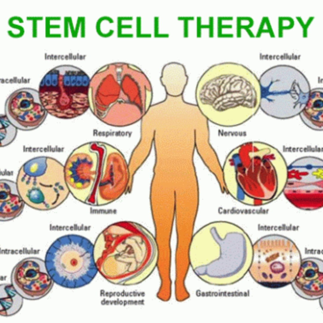 Terapi Stem Cell Diabetes, Harapan Baru Dunia Medis